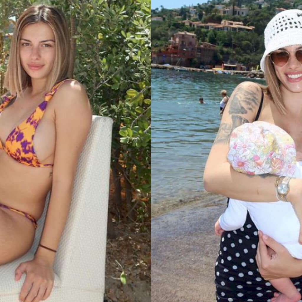 Giuseppa : sa fille victime de problèmes de peau, elle montre une photo inquiétante