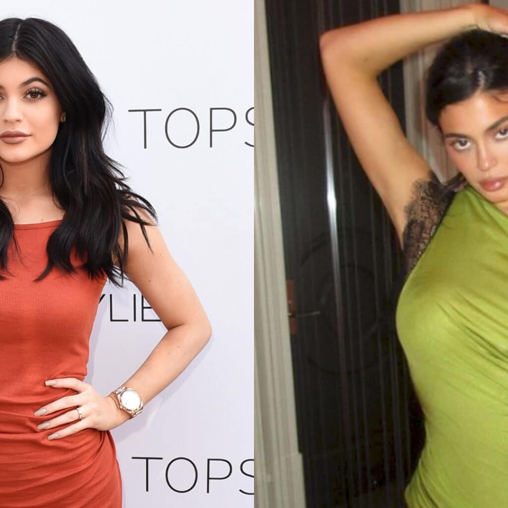 'J'aimerais ne l'avoir jamais fait' : Kylie Jenner se confie sur ce qu'elle s'est fait refaire à 19 ans