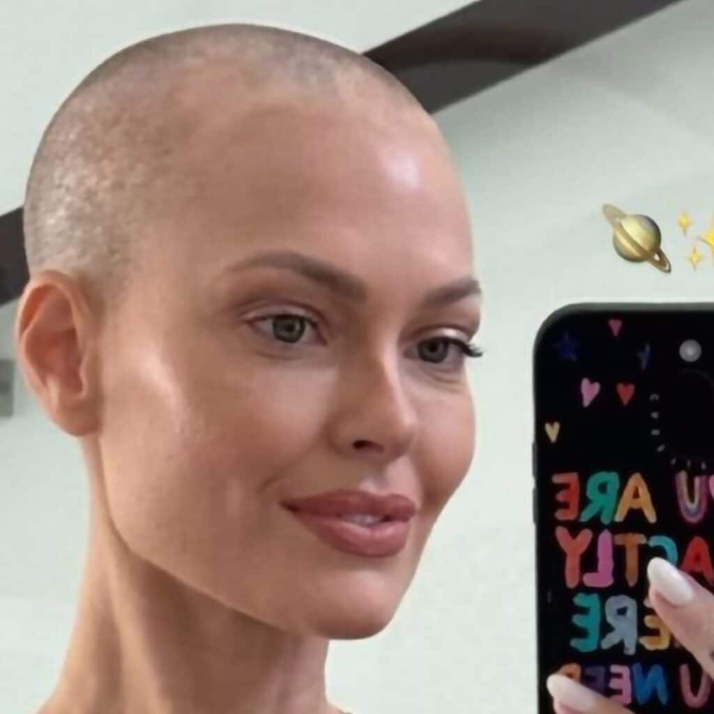 Caroline Receveur : atteinte d'un cancer du sein, elle se confie sur les effets secondaires de sa chimiothérapie