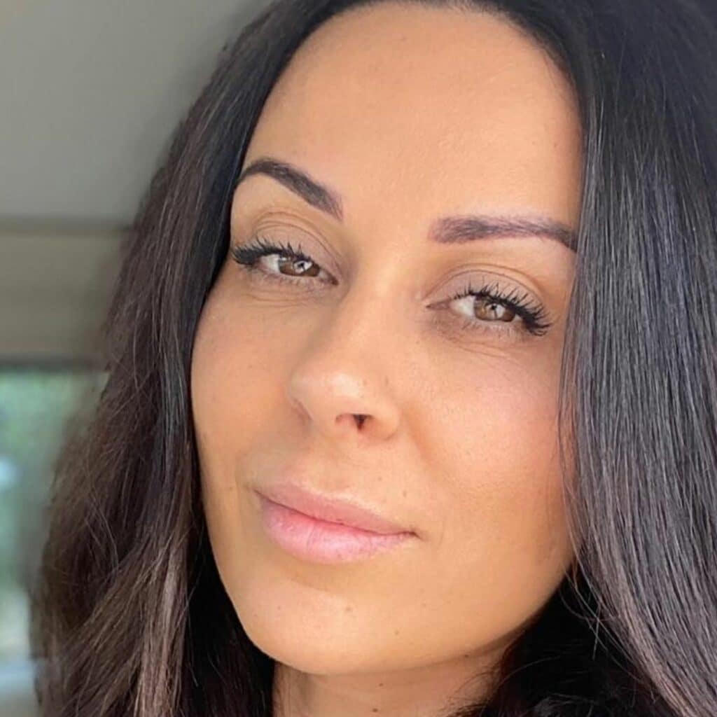 Shanna Kress : complexée par son visage, elle envisage la médecine esthétique