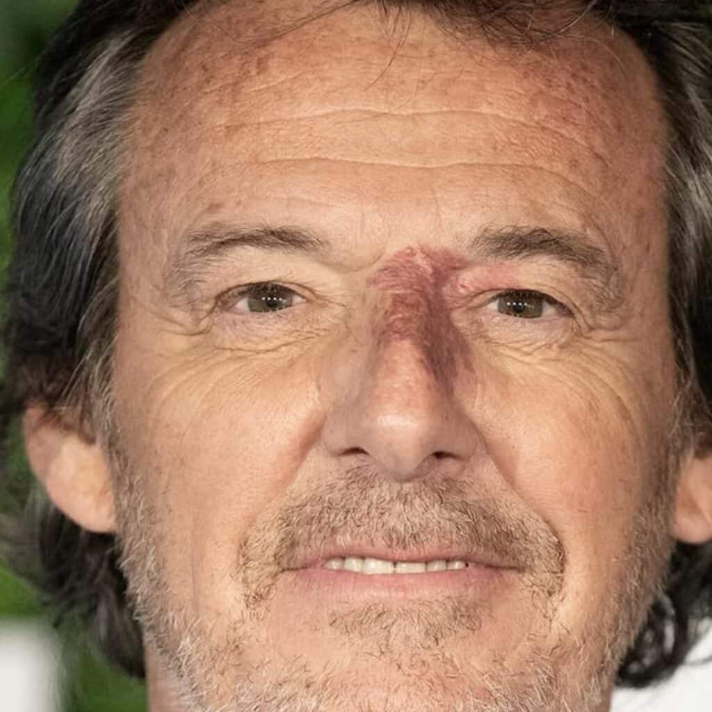 Jean-Luc Reichmann : une caissière lui parle de sa 'tâche sur le nez', la vidéo fait réagir les internautes