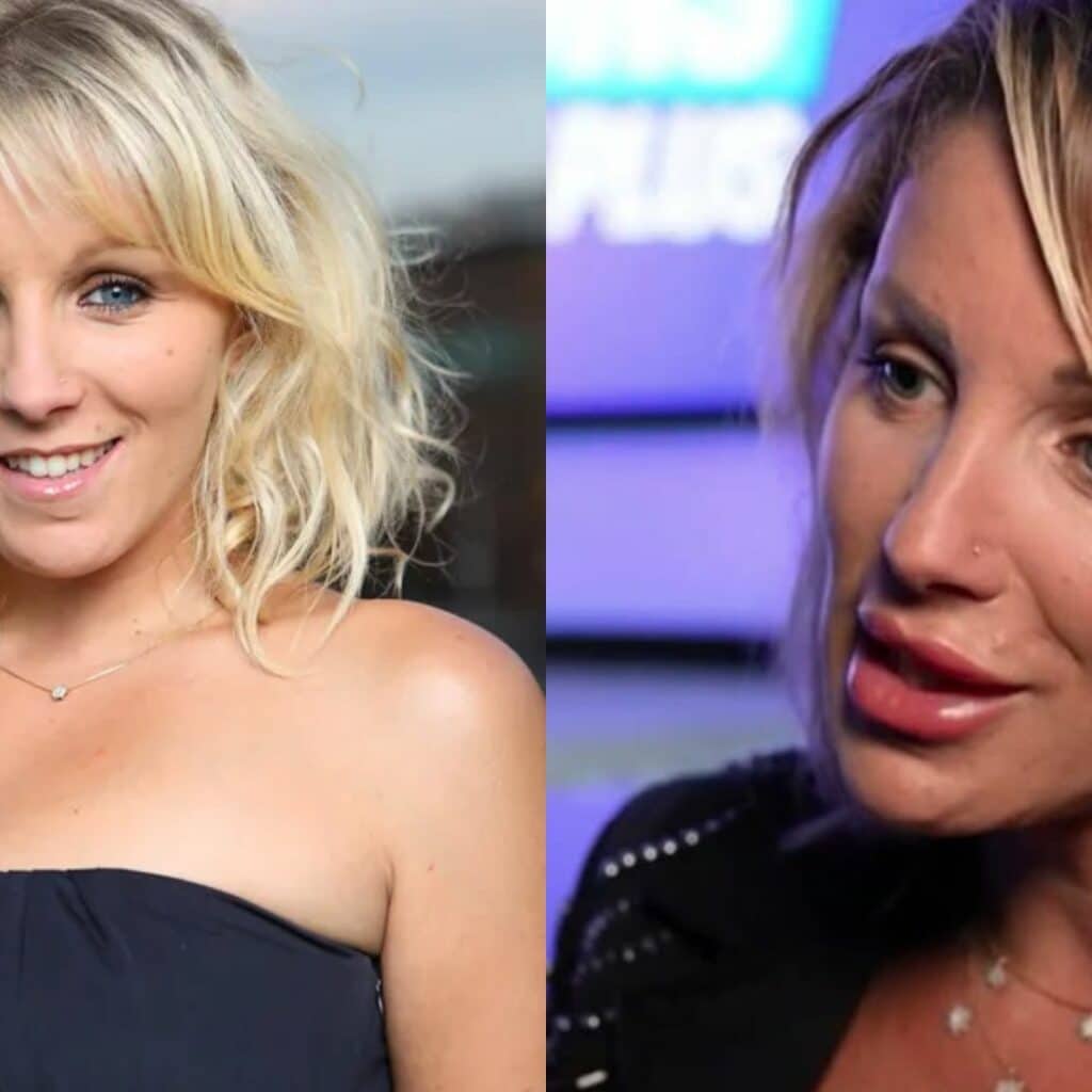 Myriam Abel : son visage métamorphosé par les injections , elle veut agir