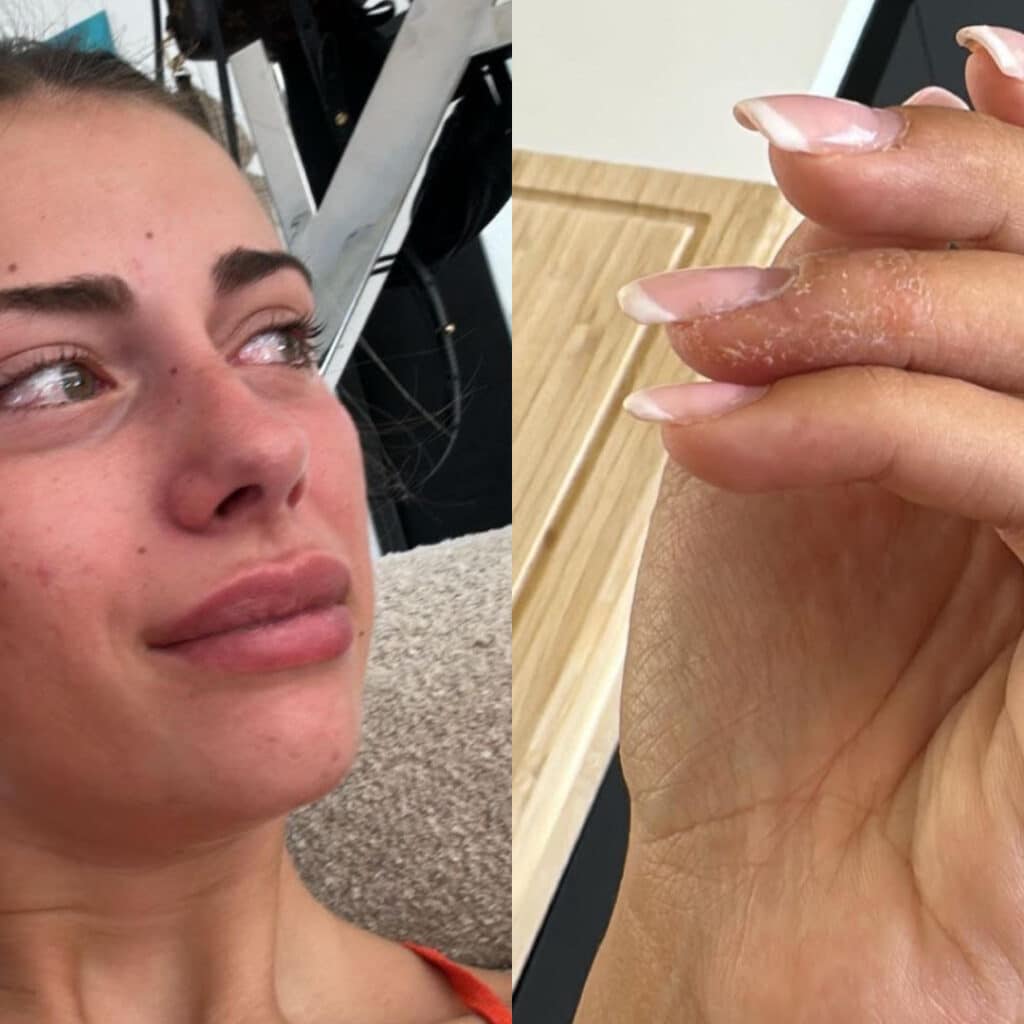'J'ai envie de me tirer...' : Giuseppa en difficultés avec sa fille, elle craque et montre ses conséquences physiques