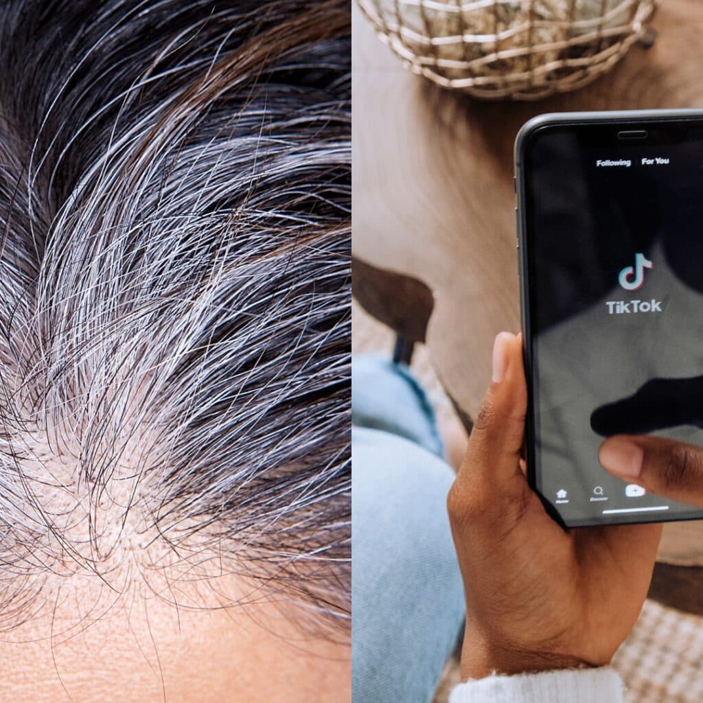 TikTok : une astuce 100% naturelle pour éliminer les cheveux blancs fait un carton