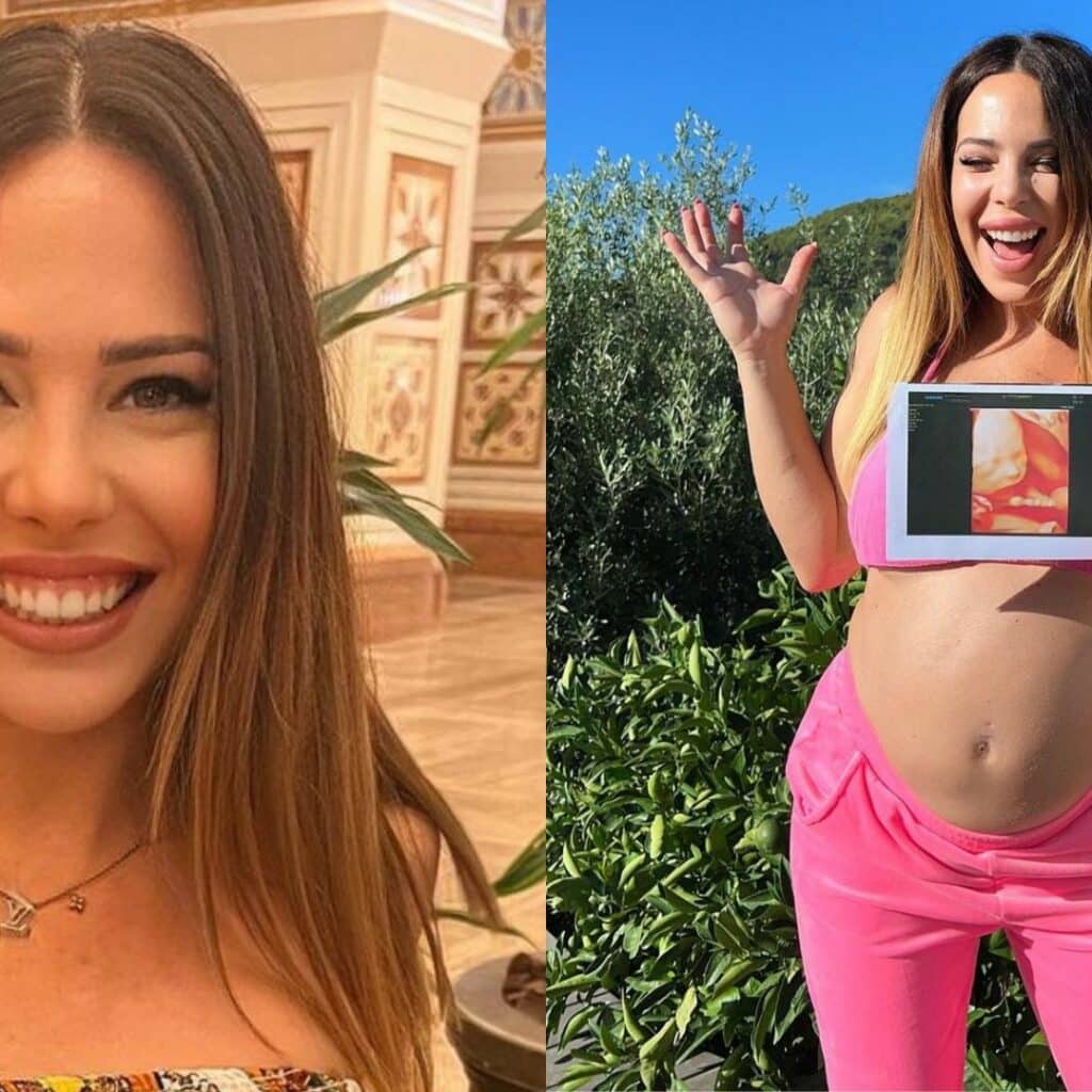Kim Glow bientôt maman : elle prévoit déjà des interventions de chirurgie esthétique après l’accouchement