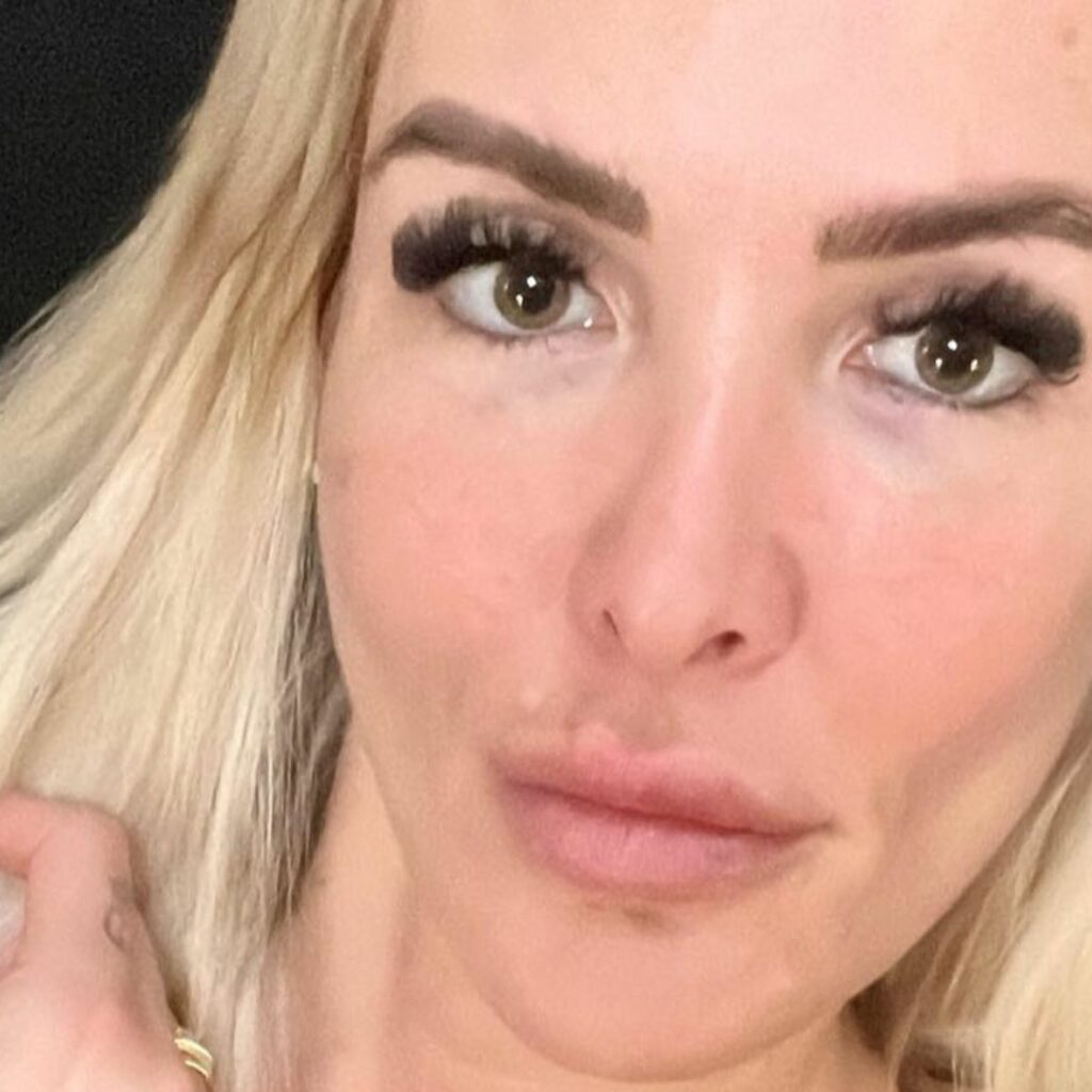 'La fin d'un cauchemar' : Marie Garet donne de ses nouvelles et inquiète avec sa grave blessure