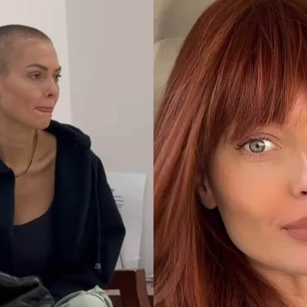 'J'ai quasi tout perdu' : Caroline Receveur se livre sur les effets secondaires de son traitement
