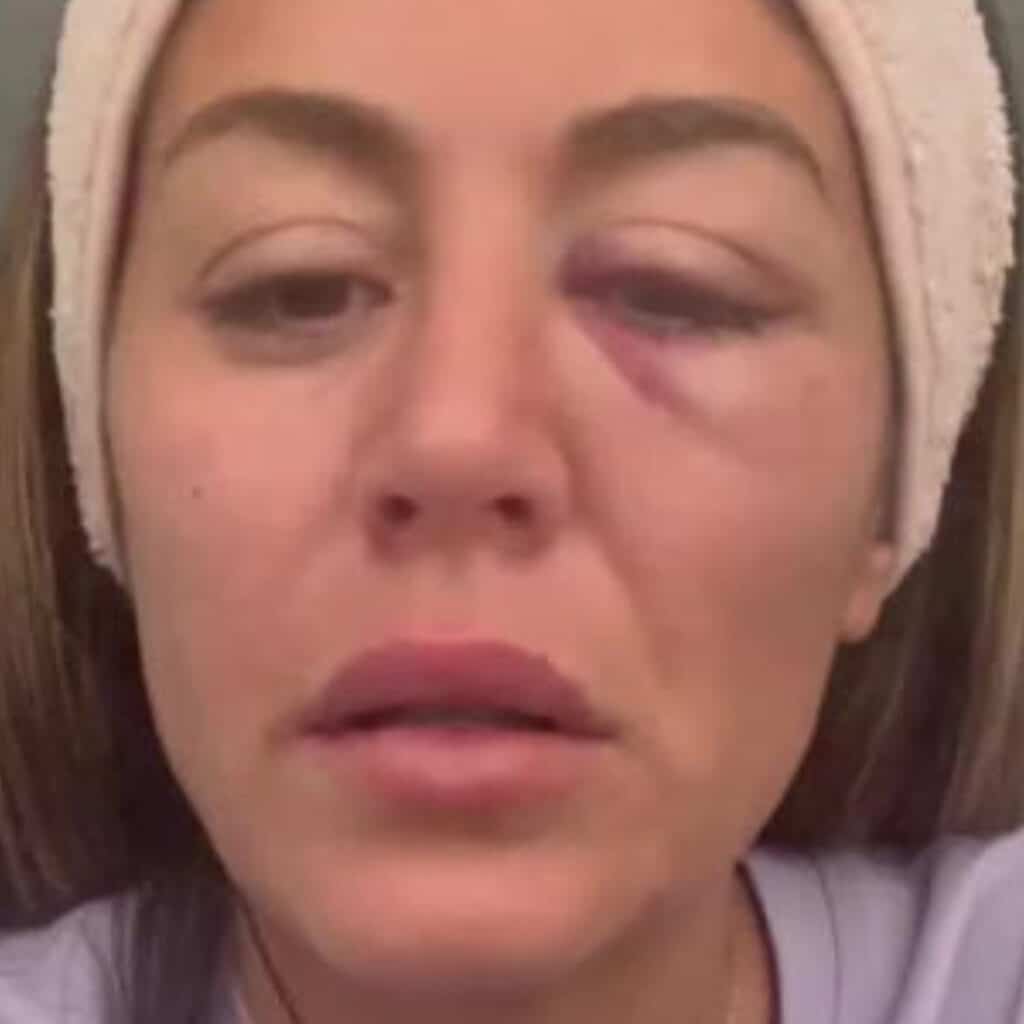'Ne pas me laisser abattre' : Anaïs Camizuli (Les Cinquante) se livre sur son état de santé après son agression
