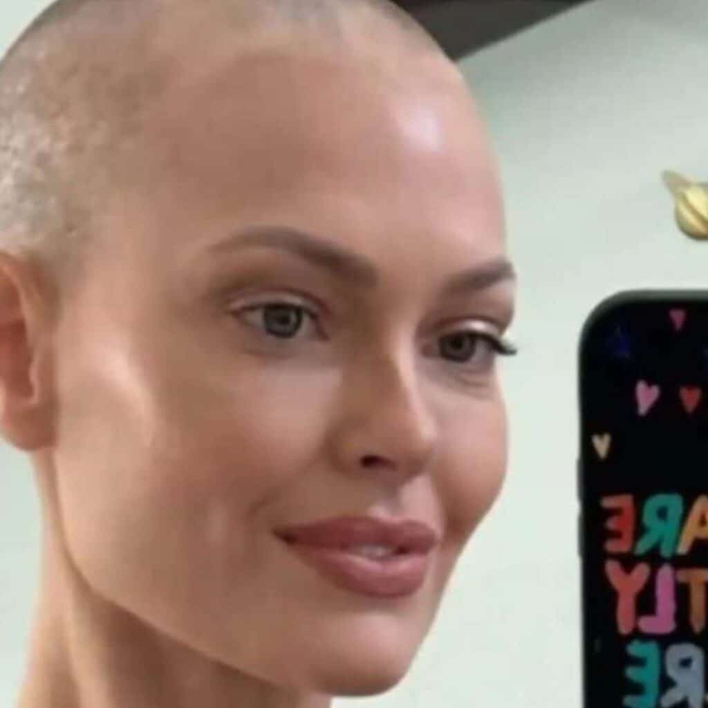 Caroline Receveur face au cancer : elle se confie sur les effets secondaires de son nouveau traitement
