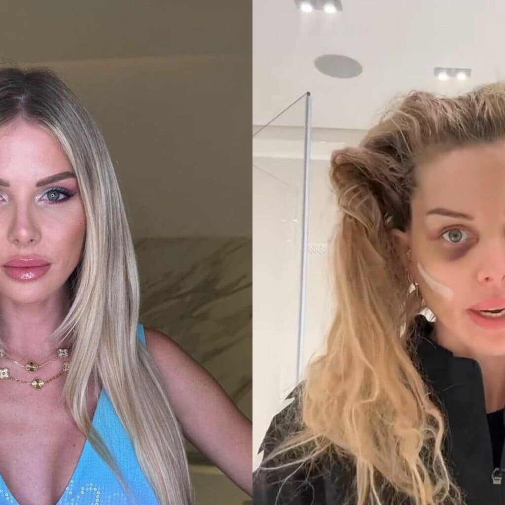 Jessica Thivenin : malvoyante à cause de son lifting, elle se livre