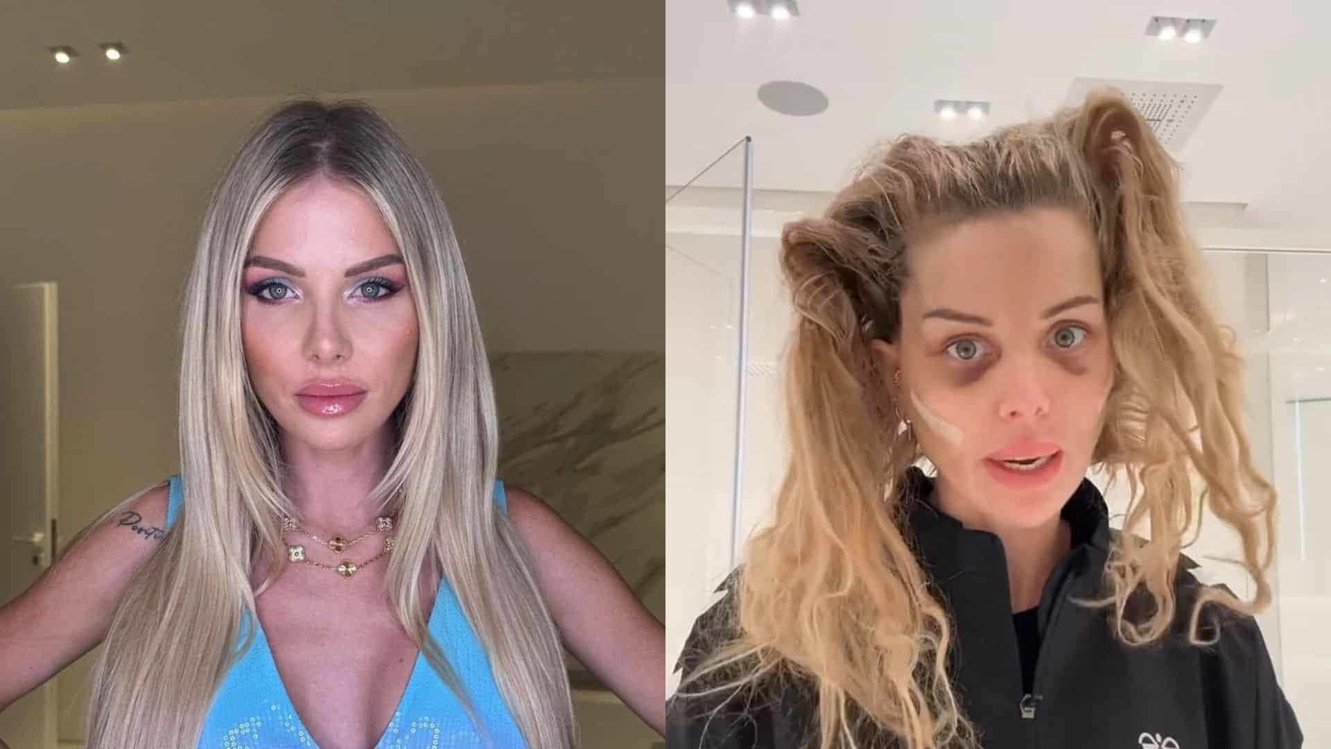 Jessica Thivenin : malvoyante à cause de son lifting, elle se livre