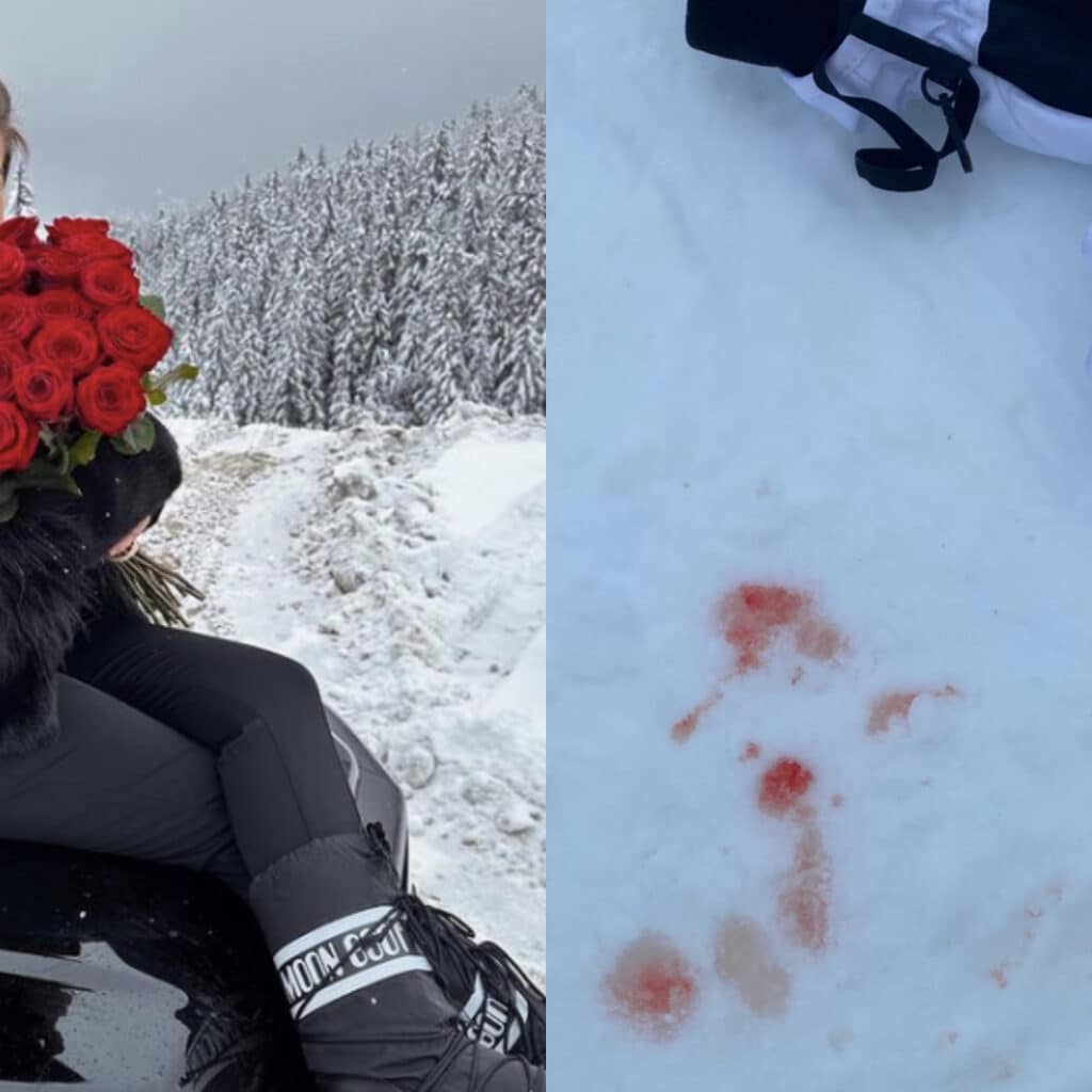 Kamila (Les Cinquante) : en vacances au ski, elle fait une grosse chute après une crise d'angoisse