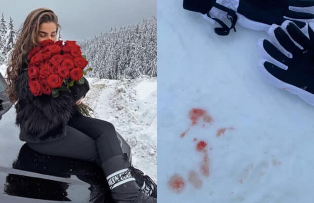 Kamila (Les Cinquante) : en sang au ski, elle fait une énorme chute après une crise d'angoisse, regardez ! Kamila (Les Cinquante) : en vacances au ski, elle fait une grosse chute après une crise d'angoisse