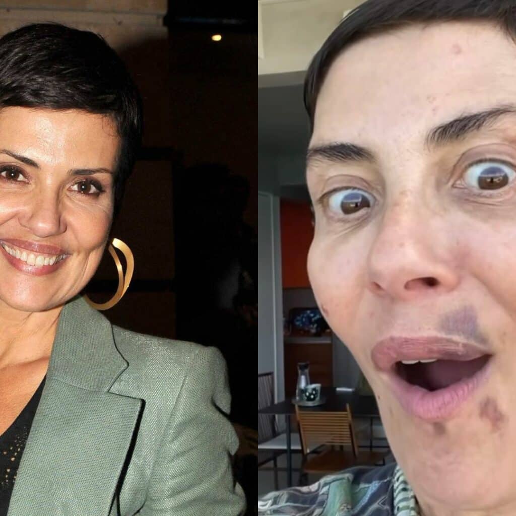 Cristina Cordula : elle se montre avec plusieurs hématomes au visage