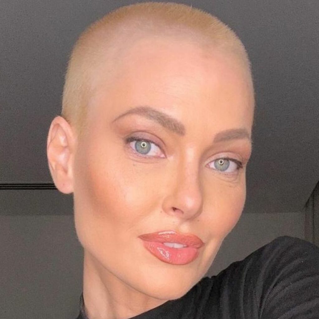Caroline Receveur guérie du cancer : elle se confie sur les effets douloureux et secondaires de son traitement