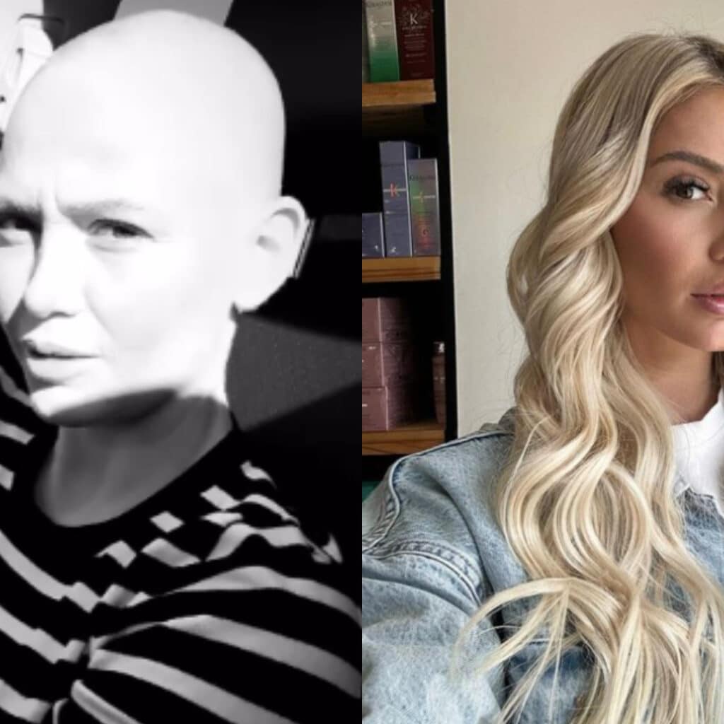 Eloïse Appelle : atteinte d'un cancer, elle explique pourquoi elle ne peut plus se raser