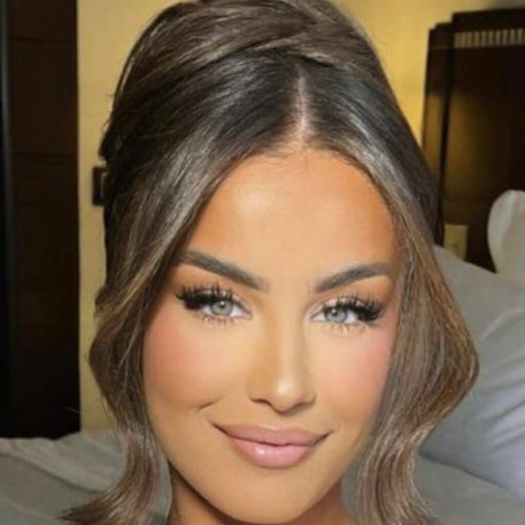 Kamila : accro à la chirurgie esthétique ? Une ancienne photo refait surface