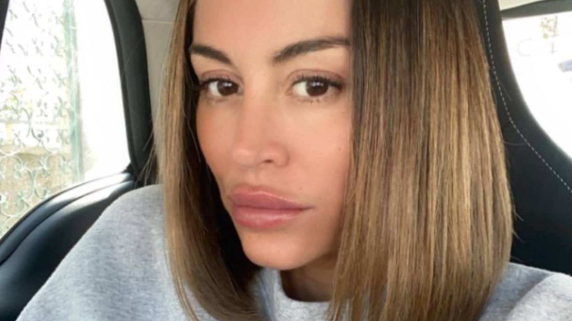 Anaïs Camizuli : accusée d'avoir eu recours de la chirurgie, elle s'emporte en plein live