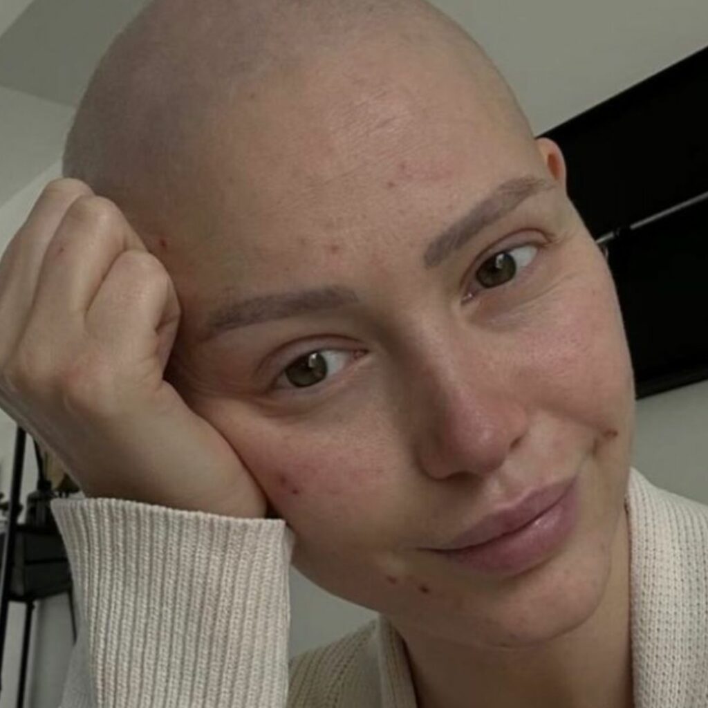 Eloïse Appelle : atteinte d'un cancer, elle se confie sur la maladie