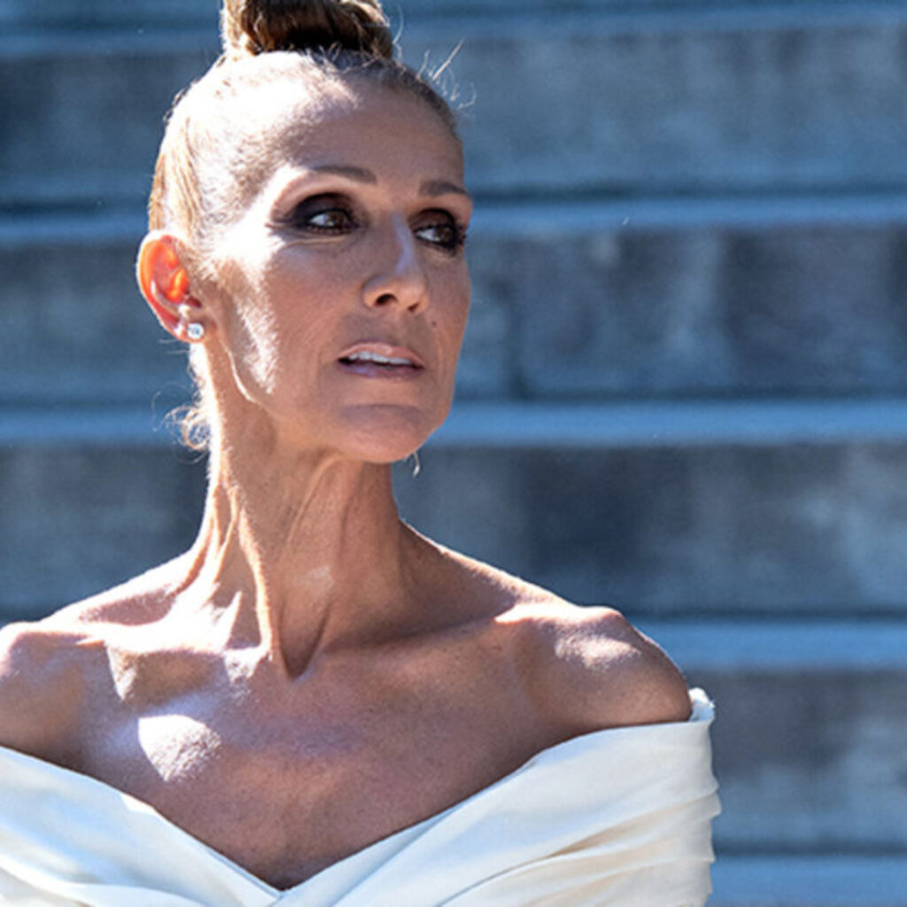 Céline Dion : pourra-t-elle rechanter un jour ? Sa neurologue répond sans filtre