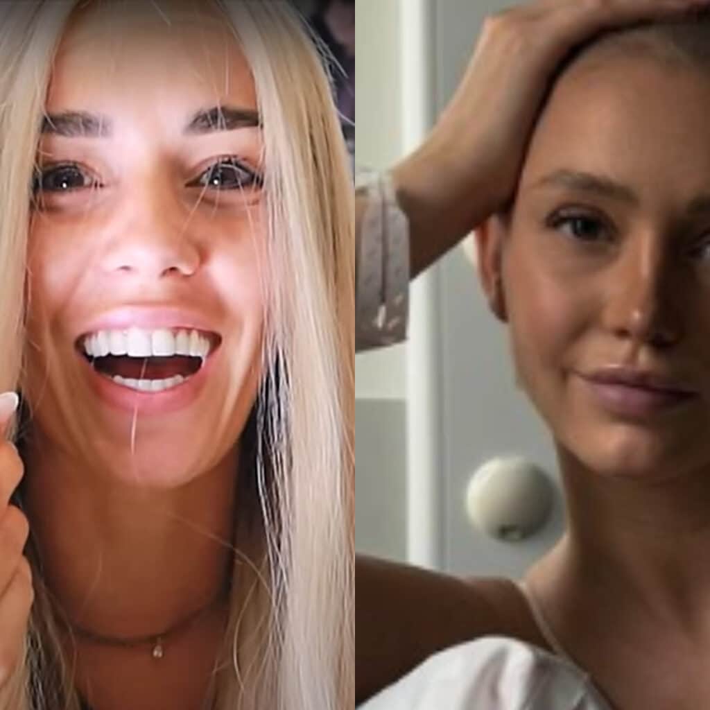 Hilona Gos : elle commente la perruque d’Éloïse Appelle, atteinte d’un cancer, ça ne passe pas