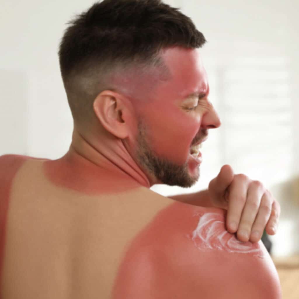 Un étudiant de 20 ans perd la vie pendant plusieurs minutes des suites d’un gros coup de soleil