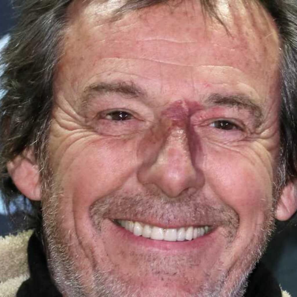 Jean-Luc Reichmann : l’animateur donne des nouvelles du chaton qu'il a trouvé