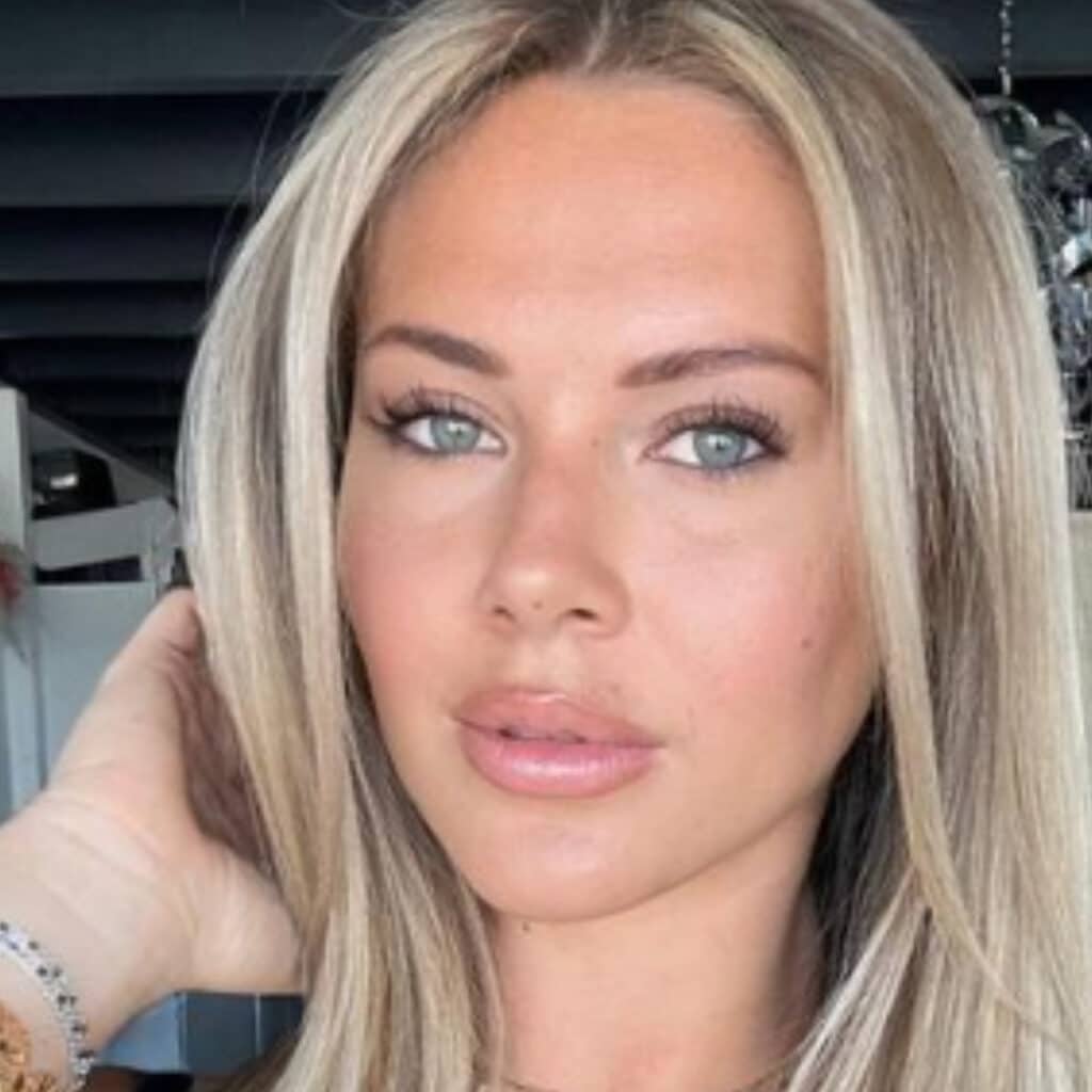 Cassandra Jullia : au plus mal après sa dernière opération de chirurgie esthétique, les internautes s'alarment