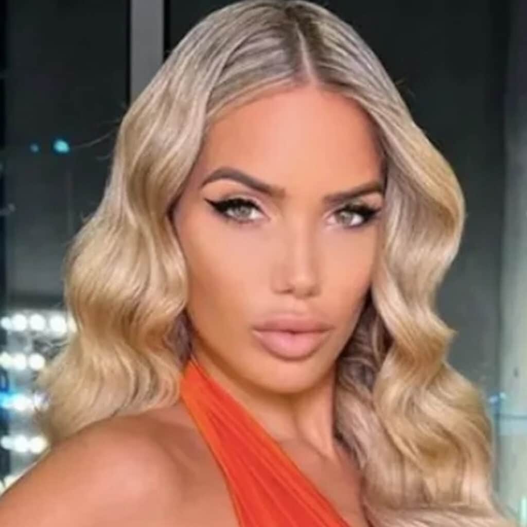 Manon Tanti : défigurée après une opération de chirurgie, elle explique ce qu'il s'est passé