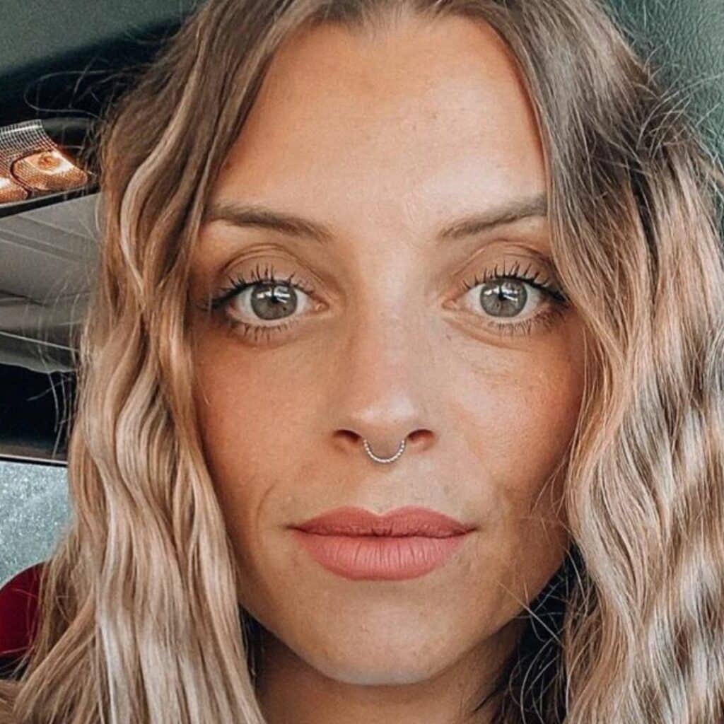 Alexia Mori (Secret Story) : défigurée, elle montre des photos troublantes de son visage