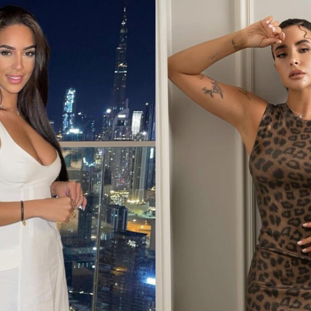Marwa Merazka : accusée de s'être fait refaire le nez pour ressembler à Rym Renom, elle répond