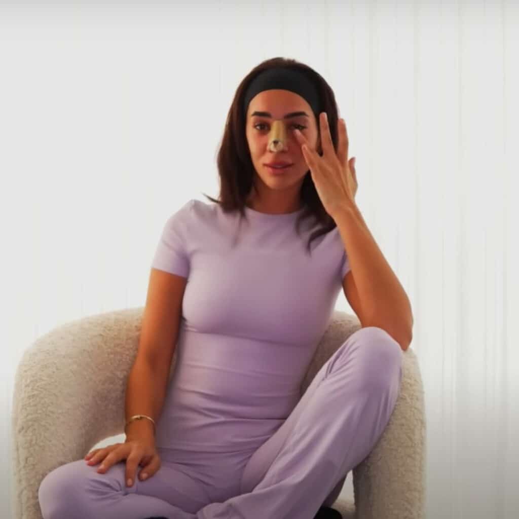 Marwa Merazka : en larmes, elle découvre pour la première fois son nouveau nez