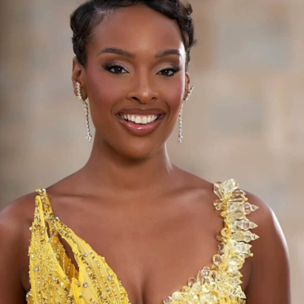 Miss France 2025 : quand Angélique Angarni-Filopon arbore une coupe cheveux longs