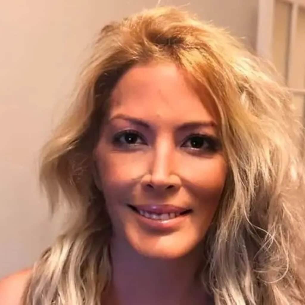 ylvie Ortega : elle s'exprime sur le "traitement lourd" de Loana