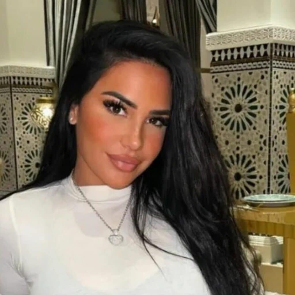 Milla Jasmine : elle refait des injections au visage, les images interpellent