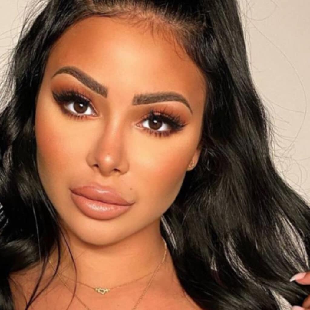 Maeva Ghennam : défigurée, elle fait une réaction allergique aux injections