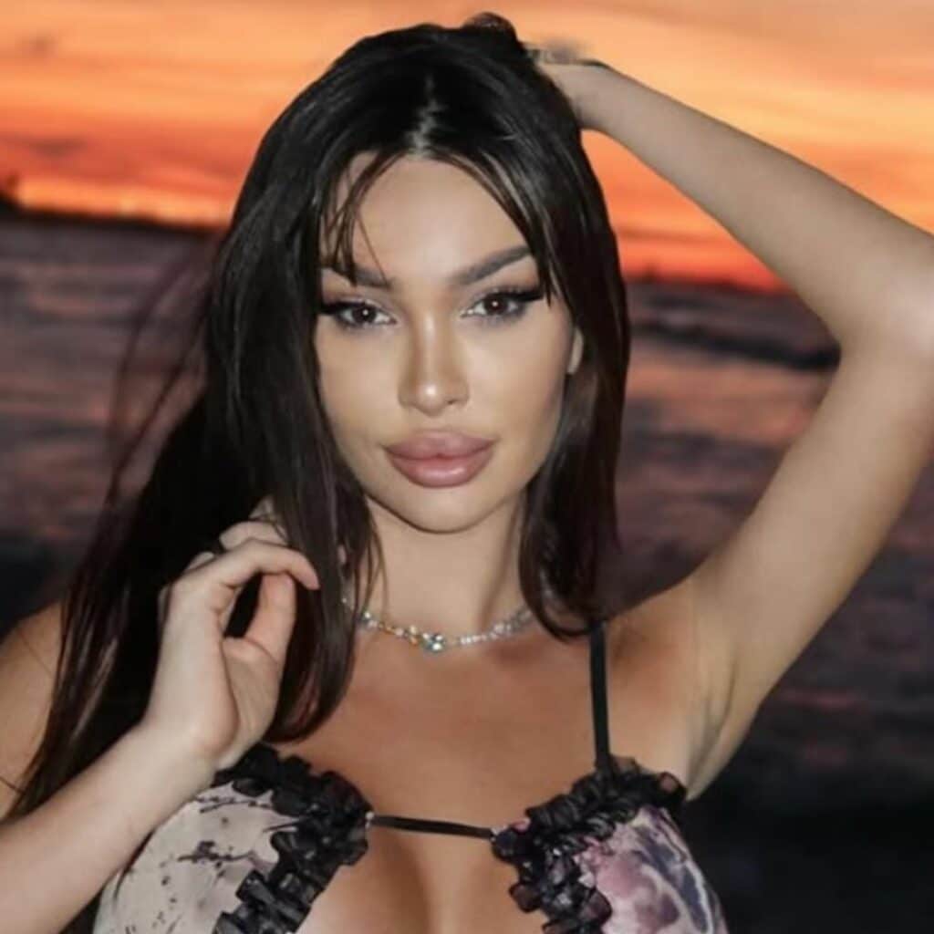 Sandra (Île de la tentation) : des photos d'elle avant la chirurgie refont surface
