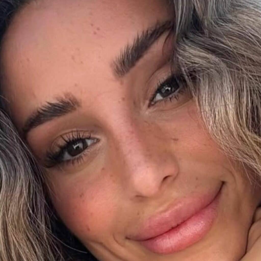 Mélanie Orl : la candidate retire ses injections
