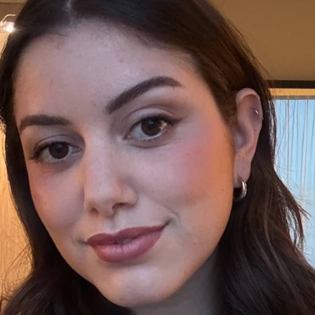 Maureen (Star Academy) : blessée durant les répétitions, elle explique la raison de son absence lors des prestiges
