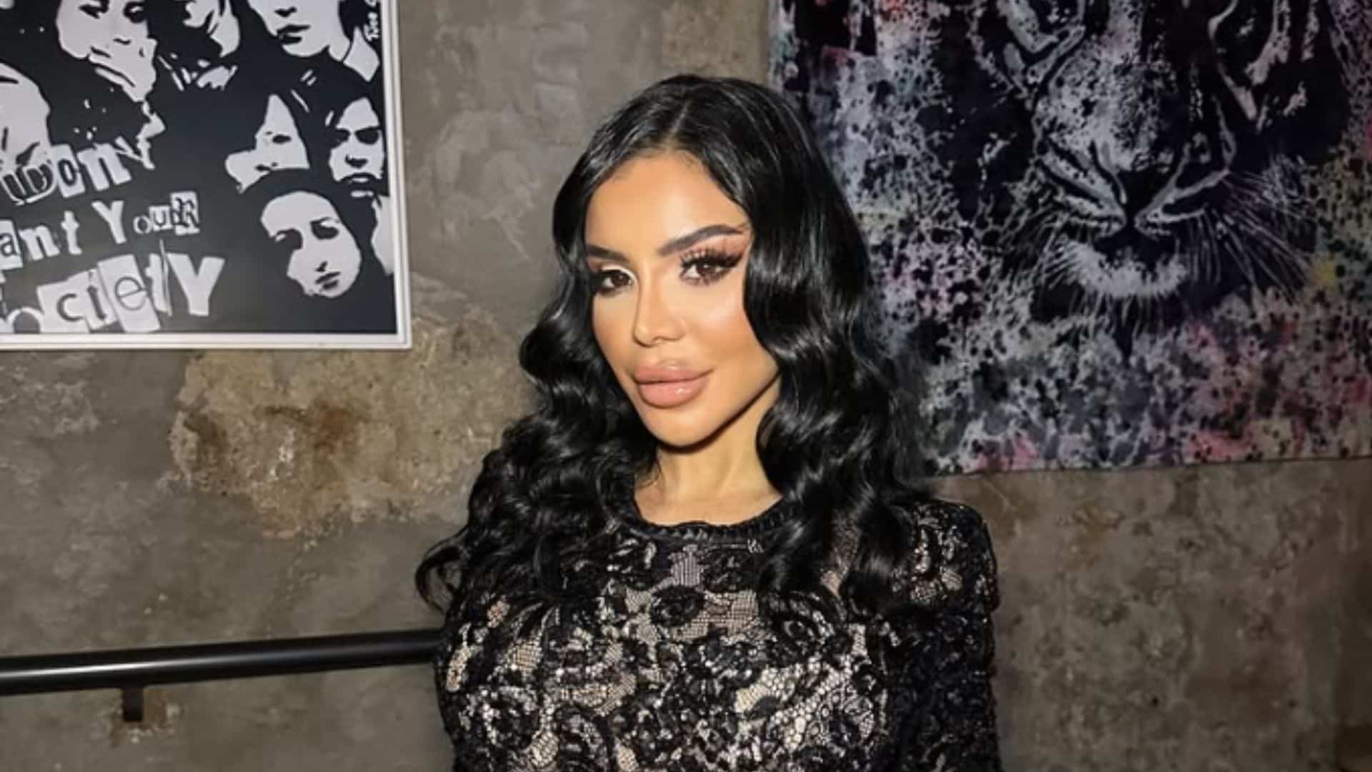 Soraya Riffy : passée à tabac, l’influenceuse montre des images de ses blessures