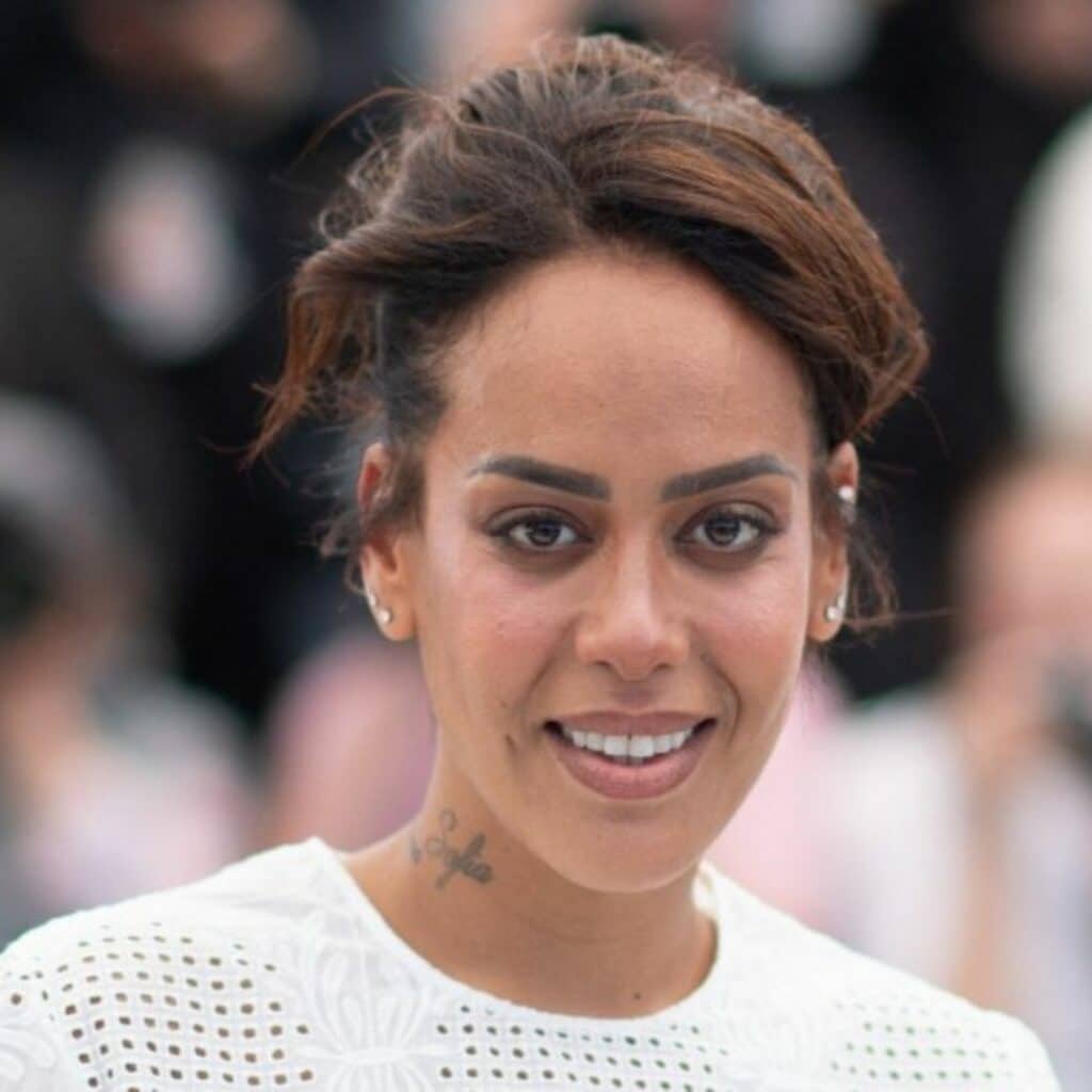 Amel Bent : elle arrive en plein concert en boîtant et brûlée au troisième degré