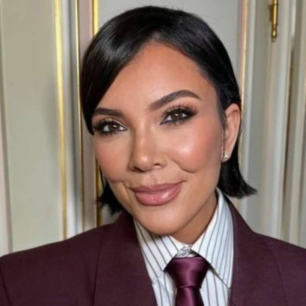 Kris Jenner méconnaissable : un chirurgien décrypte sa transformation bluffante