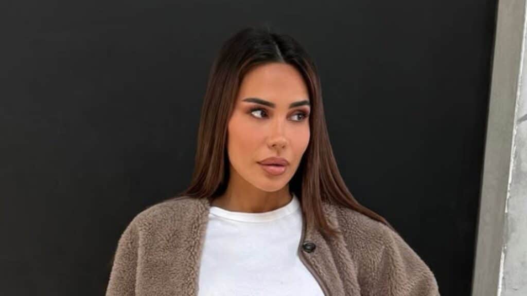 Milla Jasmine : complexée, elle se fait refaire le visage 