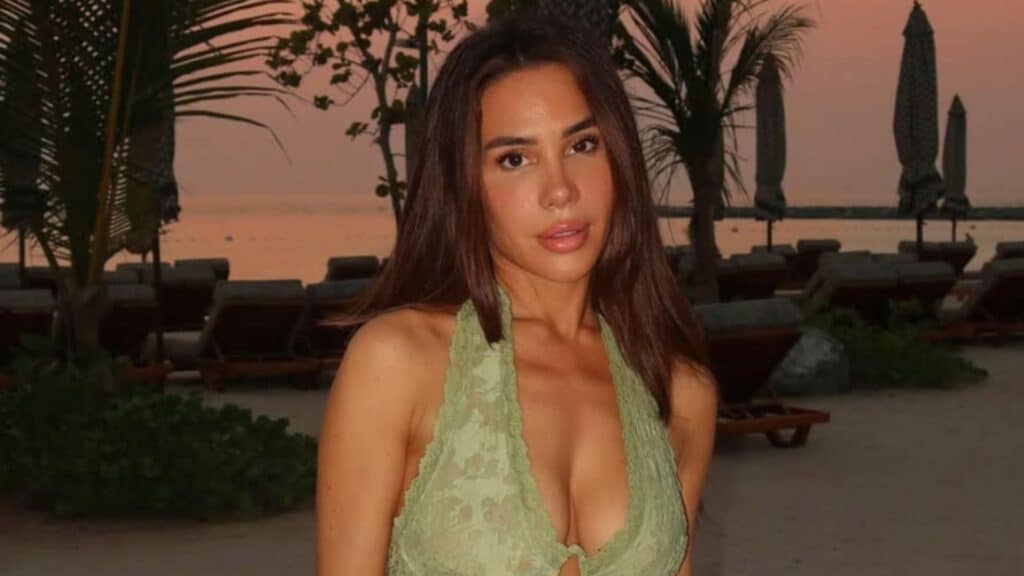 Milla Jasmine : elle montre le résultat de sa chirurgie du visage