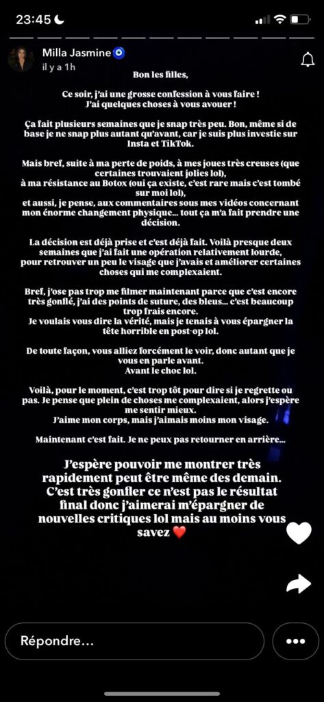 Milla Jasmine : complexée, elle se fait refaire le visage