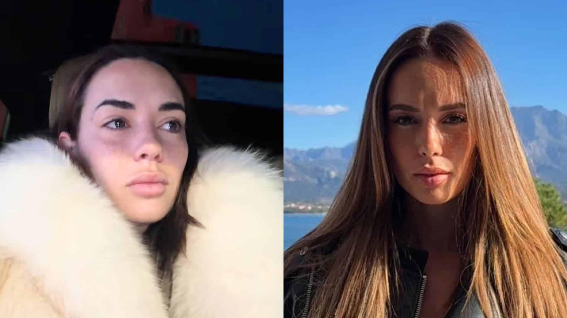 Hilona Gos : en larmes face à la maladie, la candidate annonce une mauvaise  nouvelle