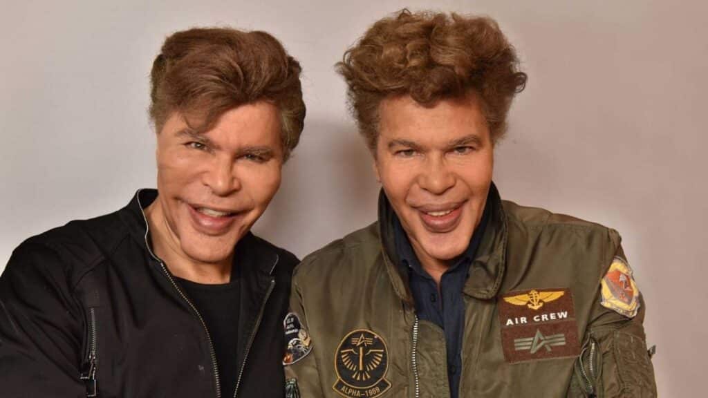 Les frères Bogdanoff : un chirurgien révèle ce qu’il s’est vraiment passé concernant leurs visages