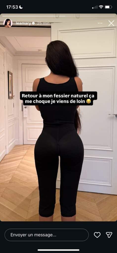 Léa Mary obligée de se refaire opérer : elle regrette avoir modifié son corps